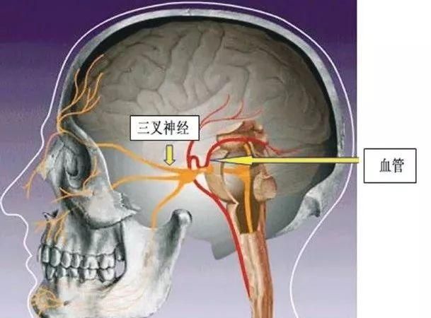 潘伟斌 王仲杰：曹操之死解密图7